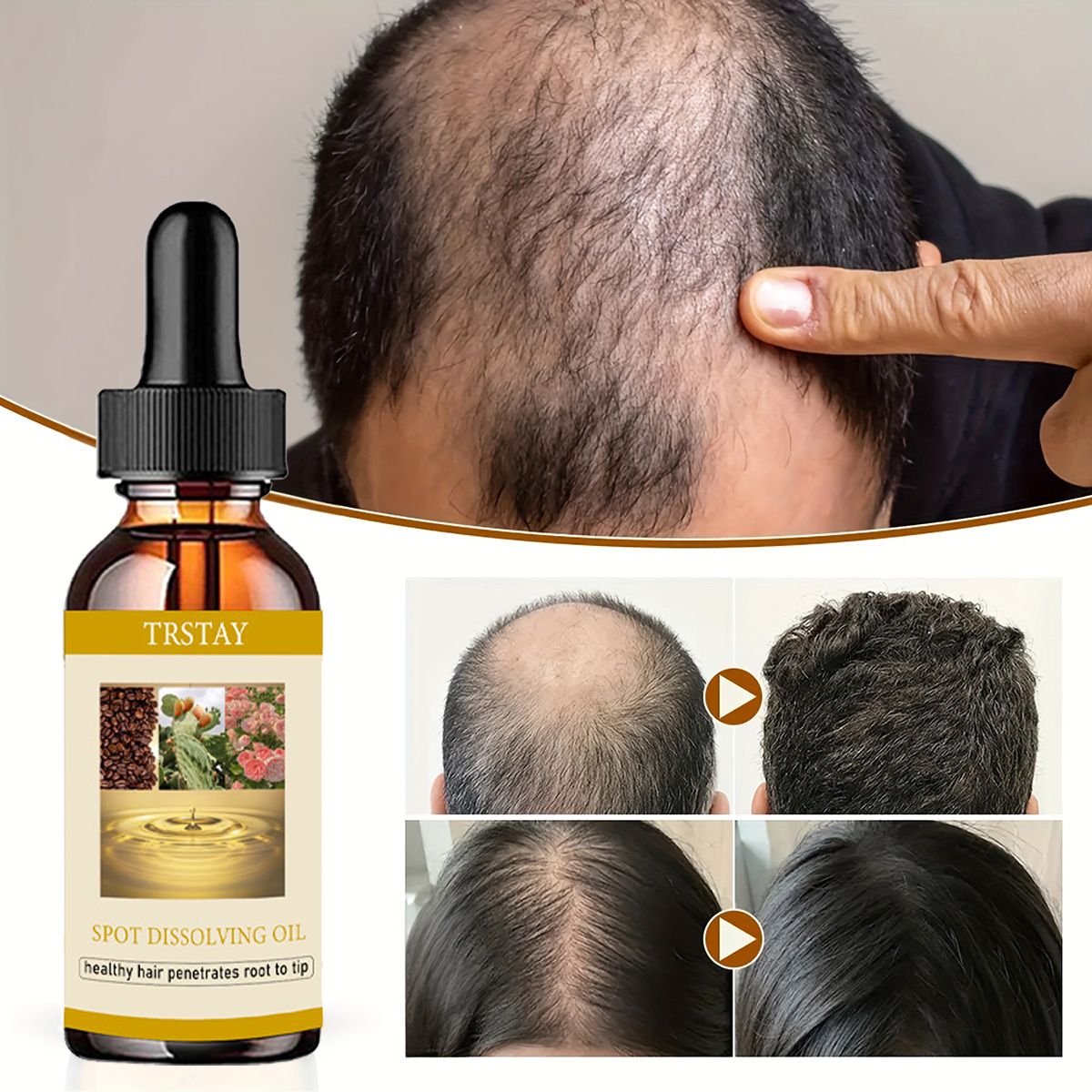 50ML aceite para el crecimient - Beard Oil Growth reseña y precio