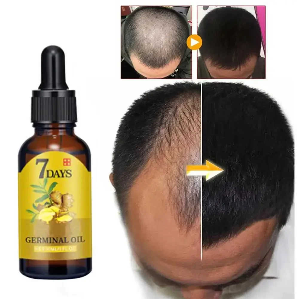 Aceite esencial de jengibre pa - Beard Oil Growth reseña y precio
